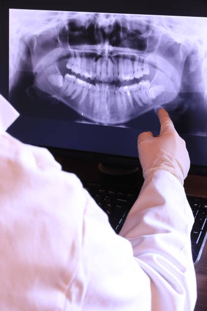 Best Emergency Dentist for Lost Fillings or Crowns in Westchester, IL